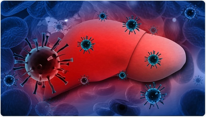 Hepatitis. Se puede evitar el contagio